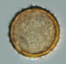  urediniospore of  P. paullula 
